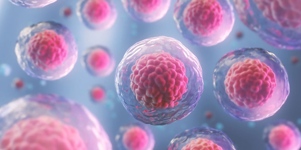 IUI